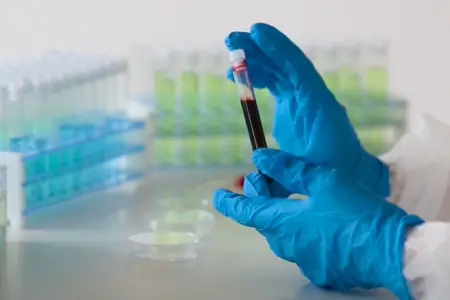 Hepatit C - gizli düşmən