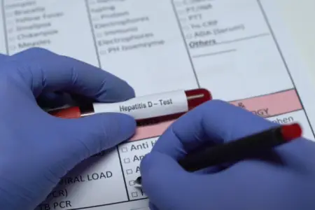Hepatit D orqanizmdə tək yaşaya bilmir