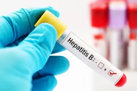 Sexually Transmitted Hepatitis