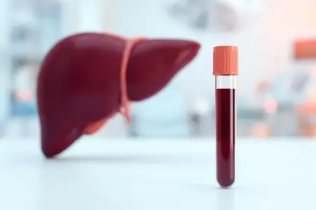 Hepatitis C Virus (HCV) - Symptoms, Complications and Treatment