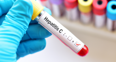 Hepatit C virusu (HCV) - əlamətləri, fəsadları və müalicəsi